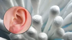 Haitallisempaa kuin luuletkaan: miksi et saisi puhdistaa korviasi vanupuikoilla?