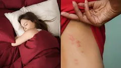 Piilevät haittaeläimet sängyssä: miten havaita ja tehokkaasti päästä eroon pölypunkeista